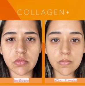 Our-blend-of-Antioxidants_-Ceramides-and-Collagen-Peptides-offers___Helps-support-collagen-and-elastin-formation__Supports-skin-hydration-and-healthy-moistu-295x300